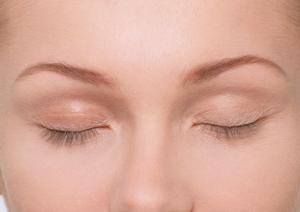 ニキビ跡は化粧水で改善できるのか